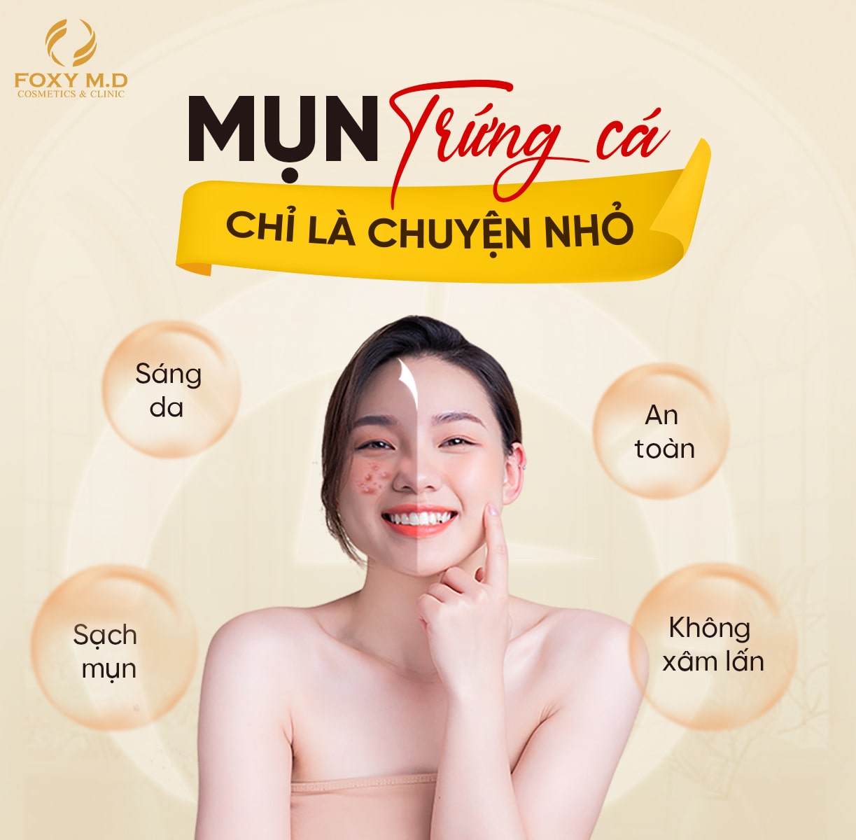 Điều trị mụn